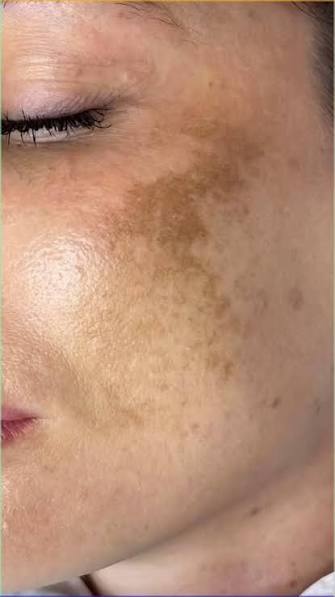 skin damage from UAE climate